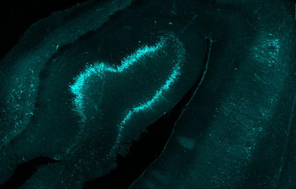 human brain slice