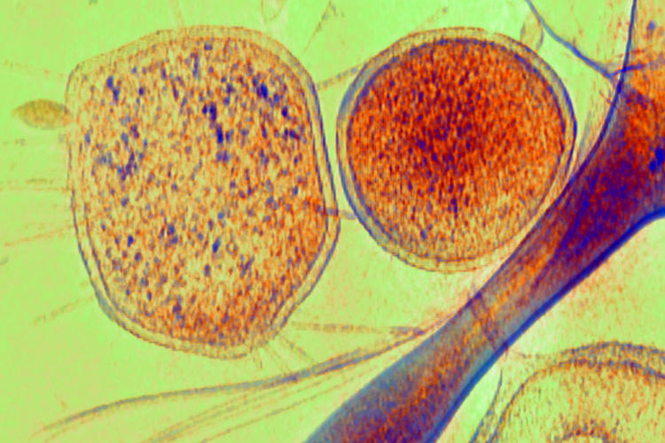 Archaea bacteria with CRISPR systems.