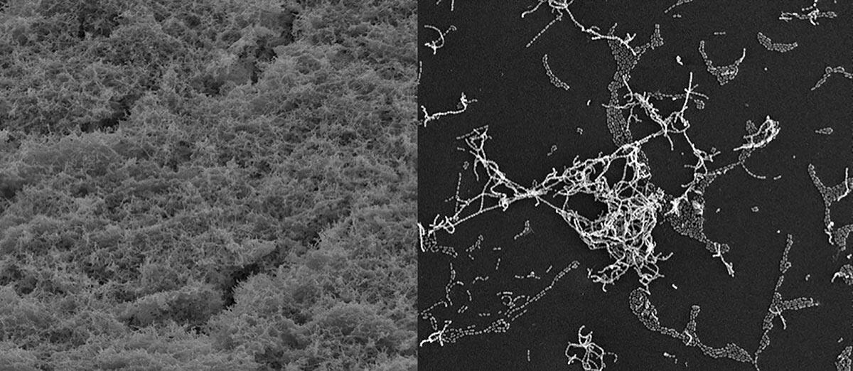 black and white fuzzy stuff next to a black and white closeup showing clumping white blobs