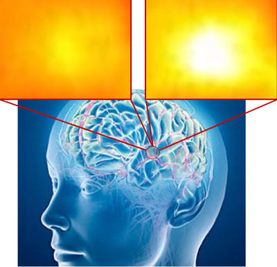 Infrared nanosensors could measure modulations in dopamine concentrations in the brain