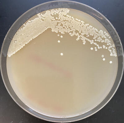 Streptomyces sample